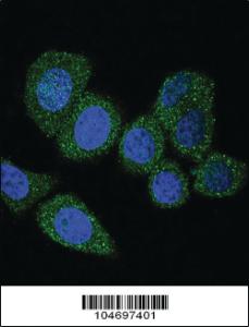 Anti-ACSL4 Rabbit Polyclonal Antibody