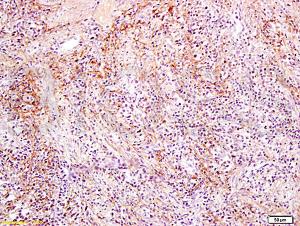 Anti-SLC22A17 Rabbit Polyclonal Antibody