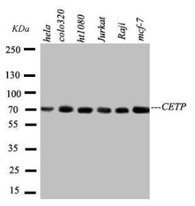 Anti-CETP Rabbit Polyclonal Antibody