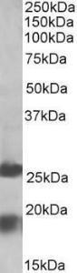 Anti-MPV17 Antibody (A84882) (2 µg/ml) staining of Human Frontal Cortex lysate (35 µg protein in RIPA buffer). Primary incubation was 1 hour. Detected by chemiluminescence