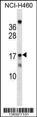 Anti-MRPS11 Rabbit Polyclonal Antibody (Biotin)