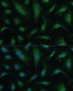 Immunofluorescence analysis of U-2 OS cells using Anti-KIF14 Antibody (A8568) at a dilution of 1:100 (40x lens) DAPI was used to stain the cell nuclei (blue)