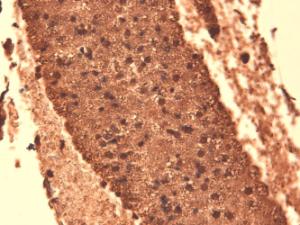 Immunohistochemistry analysis of mouse thyroid, fixed in 10% formalin solution for 12-24 hours at room temperatur