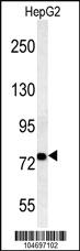 Anti-ACSL4 Rabbit Polyclonal Antibody