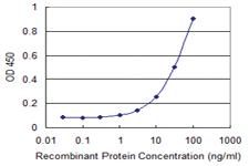 Anti-SCGB1A1 Mouse Monoclonal Antibody [clone: 1F7]