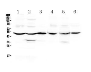 Anti-GDA Polyclonal Antibody