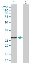 Anti-MRPL46 Mouse Polyclonal Antibody