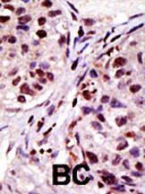 Anti-HGS Rabbit Polyclonal Antibody