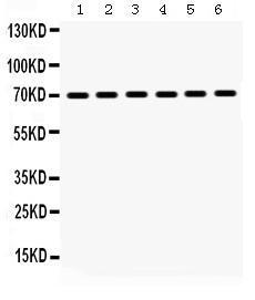 Anti-HSPA1A Rabbit Polyclonal Antibody