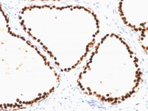 Anti-FOXA1 antibody