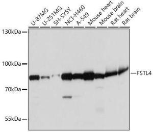 Western blot analysis of extracts of various cell lines, using Anti-FSTL4 Antibody (A306160) at 1:1,000 dilution. The secondary antibody was Goat Anti-Rabbit IgG H&L Antibody (HRP) at 1:10,000 dilution.