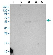 Anti-SLC39A8 Rabbit Polyclonal Antibody