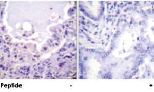 Anti-RAF1 Rabbit Polyclonal Antibody