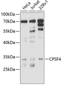 Anti-CPSF30 / NAR Rabbit Polyclonal Antibody