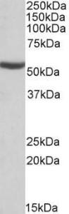 Anti-ALDH6A1 Antibody (A84883) (0.1µg/ml) staining of Mouse Kidney lysate (35µg protein in RIPA buffer). Primary incubation was 1 hour. Detected by chemiluminescence.