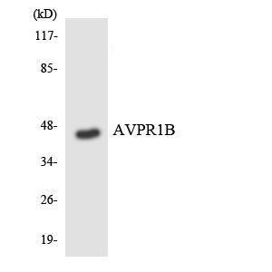 Antibody anti-AVPR1B A100606-100 100 µg