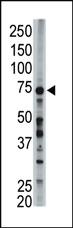 Anti-ACSL6 Rabbit Polyclonal Antibody