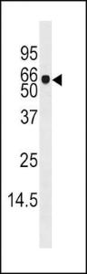 Anti-ADK Rabbit Polyclonal Antibody (AP (Alkaline Phosphatase))