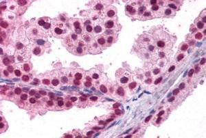 Anti-FOXA2 Antibody (A83266) (3.8µg/ml) staining of paraffin embedded Human Prostate. Steamed antigen retrieval with citrate buffer pH 6, AP-staining.