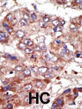 Anti-ACSL6 Rabbit Polyclonal Antibody