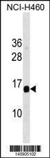 Anti-GAPT Rabbit Polyclonal Antibody (HRP (Horseradish Peroxidase))