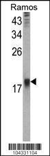 Anti-UBE2B Rabbit Polyclonal Antibody (PE (Phycoerythrin))