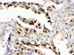 Anti-HSPA1A Rabbit Polyclonal Antibody