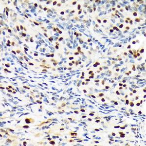 Immunohistochemistry analysis of paraffin-embedded rat ovary using Anti-Baf180 Antibody [ARC1820] (A309071) at a dilution of 1:100 (40X lens). Perform microwave antigen retrieval with 10 mM Tris/EDTA buffer pH 9.0 before commencing with IHC staining protocol