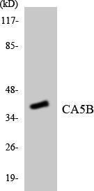 Western blot analysis of the lysates from HT 29 cells using Anti-CA5B Antibody