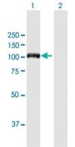 Anti-DIAPH3 Mouse Polyclonal Antibody