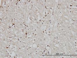 Anti-DNAJB2 Mouse Monoclonal Antibody [clone: 2C9]