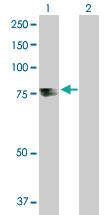 Anti-TDP1 Rabbit Polyclonal Antibody