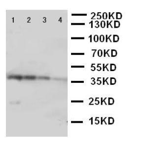 Anti-PKR Rabbit Polyclonal Antibody