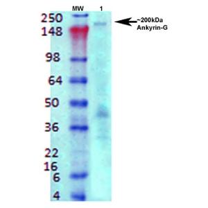 Western blot analysis of rat brain membrane lysate showing detection of Ankyrin G protein using Anti-ANK-3 Antibody [S106-20] (A305040) at 1:1000