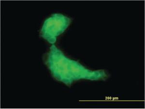 Anti-DNAJB2 Mouse Monoclonal Antibody [clone: 2C9]