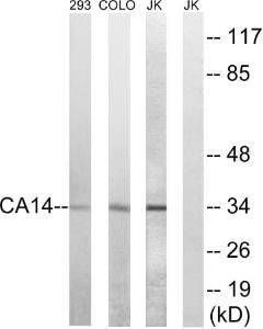 Western blot analysis of lysates from Jurkat, COLO, and 293 cells using Anti-CA14 Antibody. The right hand lane represents a negative control, where the antibody is blocked by the immunising peptide.