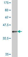 Anti-UGT1A3 Mouse Polyclonal Antibody