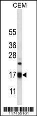 Anti-MRPS12 Rabbit Polyclonal Antibody (APC (Allophycocyanin))