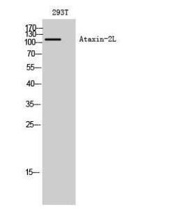 Anti-Ataxin 2-like Rabbit Polyclonal Antibody