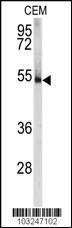 Anti-PRKAR1A Rabbit Polyclonal Antibody (Biotin)