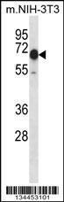 Anti-CAMKK2 Rabbit Polyclonal Antibody (Biotin)