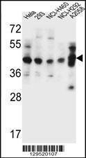 Anti-GTF2H2C Rabbit Polyclonal Antibody (FITC (Fluorescein Isothiocyanate))