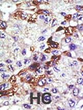 Anti-UBE2E3 Rabbit Polyclonal Antibody (FITC (Fluorescein))