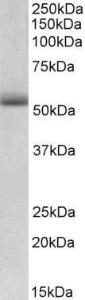 Anti-TRIM72 Antibody (A84884) (0.01µg/ml) staining of Mouse Heart lysate (35µg protein in RIPA buffer). Primary incubation was 1 hour. Detected by chemiluminescence.