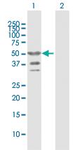 Anti-TRIP6 Rabbit Polyclonal Antibody