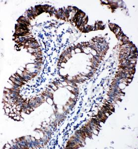 Anti-EIF2S1 Rabbit Polyclonal Antibody