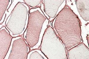 Anti-TRIM72 Antibody (A84884) (3.8µg/ml) staining of paraffin embedded Human Skeletal Muscle. Steamed antigen retrieval with citrate buffer pH 6, AP-staining.