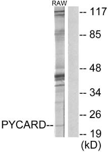 Western blot analysis of lysates from RAW264.7 cells using Anti-ASC Antibody. The right hand lane represents a negative control, where the antibody is blocked by the immunising peptide