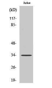 Western blot analysis of various cells using Anti-CA14 Antibody