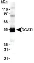 Anti-DGAT1 Rabbit Polyclonal Antibody